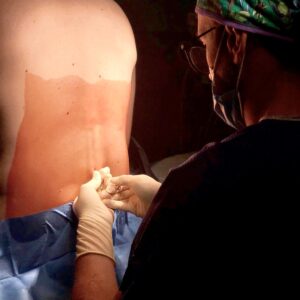 FEA Anestesiología y Reanimación
