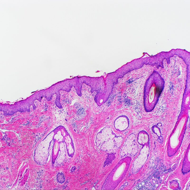 Técnico Especialista en Anatomía Patológica